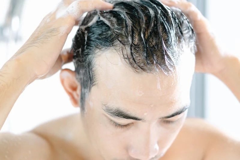 young man serious hair loss