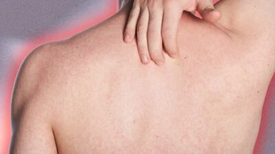 The Adult Man 6 best Body Washes for Back Acne Man Scratching Irritated Back